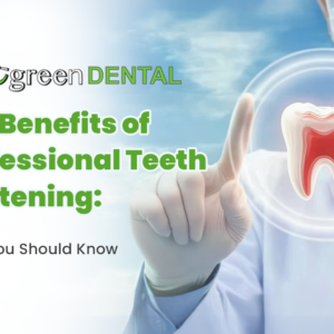 The Benefits of Professional Teeth Whitening: What You Should Know