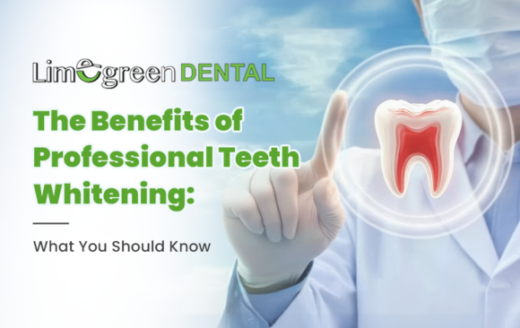 The Benefits of Professional Teeth Whitening: What You Should Know